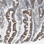 Immunohistochemical staining of human duodenum shows strong granular cytoplasmic positivity in glandular cells.