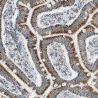 Anti-GSTK1 Antibody