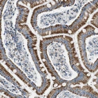 Immunohistochemical staining of human small intestine shows strong granular cytoplasmic positivity in glandular cells.