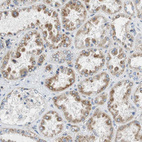 Anti-GSTK1 Antibody