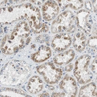 Immunohistochemical staining of human kidney shows moderate granular cytoplasmic positivity in cells in tubules.