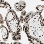 Immunohistochemical staining of human placenta shows strong nuclear positivity in trophoblastic cells.