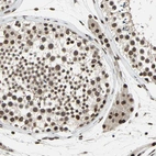 Immunohistochemical staining of human testis shows strong nuclear positivity in cells in seminiferous ducts.
