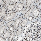 Immunohistochemical staining of human kidney shows moderate nuclear positivity in cells in tubules.