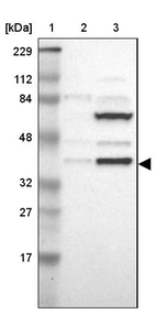 Lane 1: Marker [kDa] 229, 112, 84, 48, 32, 27, 17_br/_Lane 2: Human cell line RT-4_br/_Lane 3: Human cell line U-251MG sp