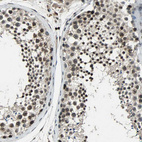 Anti-NR2C2 Antibody