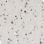 Immunohistochemical staining of human cerebral cortex shows strong nuclear positivity in neurons.