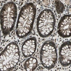 Immunohistochemical staining of human rectum shows strong nuclear positivity in glandular cells.