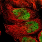 Immunofluorescent staining of human cell line A-431 shows localization to nucleoplasm.