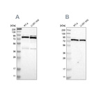 Western blot analysis using Anti-PARN antibody HPA006314 (A) shows similar pattern to independent antibody HPA012010 (B).