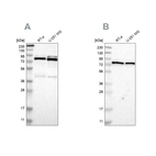 Western blot analysis using Anti-PARN antibody HPA006314 (A) shows similar pattern to independent antibody HPA012010 (B).