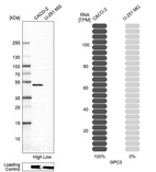 Anti-GPC3 Antibody