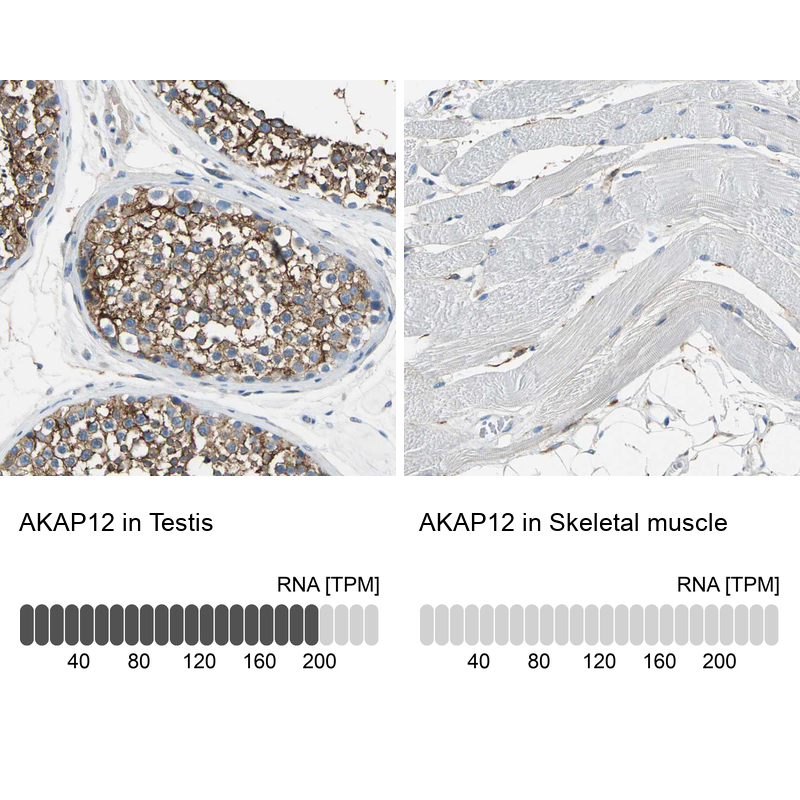 Anti-AKAP12 Antibody