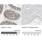 Anti-AKAP12 Antibody
