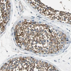 Immunohistochemical staining of human testis shows strong membranous positivity in cells in seminiferous ducts.