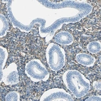 Immunohistochemical staining of human endometrium shows moderate positivity in cells in endometrial stroma.