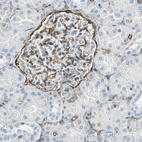 Immunohistochemical staining of human kidney shows strong positivity in cells in glomeruli.