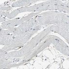 Immunohistochemical staining of human skeletal muscle shows no positivity in myocytes as expected.