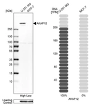 Western blot analysis in human cell line U-251 MG and human cell line MCF-7.
