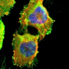 Immunofluorescent staining of human cell line U-251 MG shows localization to plasma membrane & cytosol.