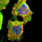 Immunofluorescent staining of human cell line U-251 MG shows localization to plasma membrane & cytosol.