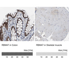 Anti-RBM47 Antibody