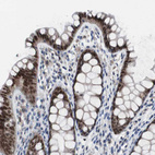 Immunohistochemical staining of human colon shows strong nuclear positivity in glandular cells.