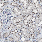 Anti-RBM47 Antibody