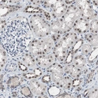 Immunohistochemical staining of human kidney shows moderate nuclear positivity in cells in tubules.