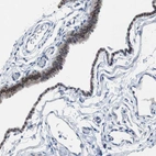 Immunohistochemical staining of human fallopian tube shows moderate nuclear positivity in glandular cells.