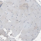 Immunohistochemical staining of human skeletal muscle shows no positivity in myocytes as expected.