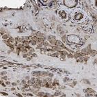 Anti-SCUBE2 Antibody