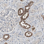 Anti-HPRT1 Antibody