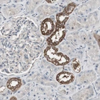 Immunohistochemical staining of human kidney shows strong cytoplasmic positivity in cells in distal tubules.