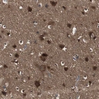 Immunohistochemical staining of human cerebral cortex shows strong cytoplasmic positivity in neurons.