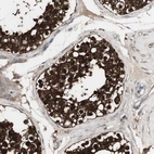 Immunohistochemical staining of human testis shows very strong cytoplasmic positivity in cells in seminiferous ducts.