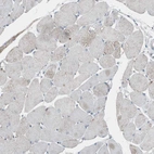 Immunohistochemical staining of human skeletal muscle shows no positivity in myocytes as expected.