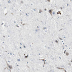 Immunohistochemical staining of human cerebral cortex shows weak cytoplasmic positivity in neurons as expected.