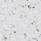 Immunohistochemical staining of human cerebral cortex shows weak cytoplasmic positivity in neurons as expected.
