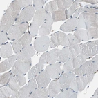 Immunohistochemical staining of human skeletal muscle shows low positivity in myocytes as expected.