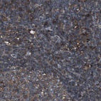 Immunohistochemical staining of human lymph node shows strong cytoplasmic positivity in germinal center cells.