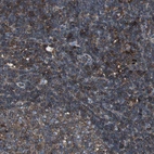 Immunohistochemical staining of human lymph node shows strong cytoplasmic positivity in germinal center cells.