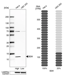 Western blot analysis in human cell lines HeLa and HEK293 using Anti-B2M antibody. Corresponding B2M RNA-seq data are presented for the same cell lines. Loading control: Anti-HSP90B1.