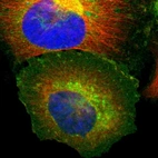 Immunofluorescent staining of human cell line U-251 MG shows localization to plasma membrane, cytosol & the Golgi apparatus.