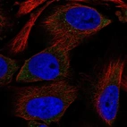 Immunofluorescent staining of human cell line U-251 MG shows localization to cytosol.