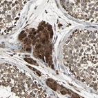 Anti-POLRMT Antibody