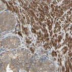 Immunohistochemical staining of human prostate shows strong granular cytoplasmic positivity in smooth muscle cells.