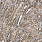 Anti-POLRMT Antibody