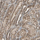 Immunohistochemical staining of human kidney shows moderate granular cytoplasmic positivity in cells in tubules.