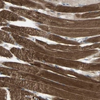 Immunohistochemical staining of human skeletal muscle shows strong granular cytoplasmic positivity in myocytes.